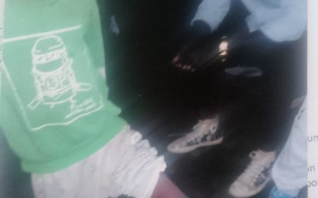 Rumonge: Indongozi zatabarije umwana yavunywe ukuguru n'imbonerakure none bafunzwe icamaso haraheze amasaha 6