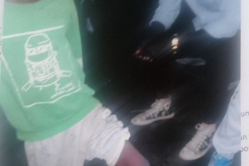 Rumonge: Indongozi zatabarije umwana yavunywe ukuguru n'imbonerakure none bafunzwe icamaso haraheze amasaha 6